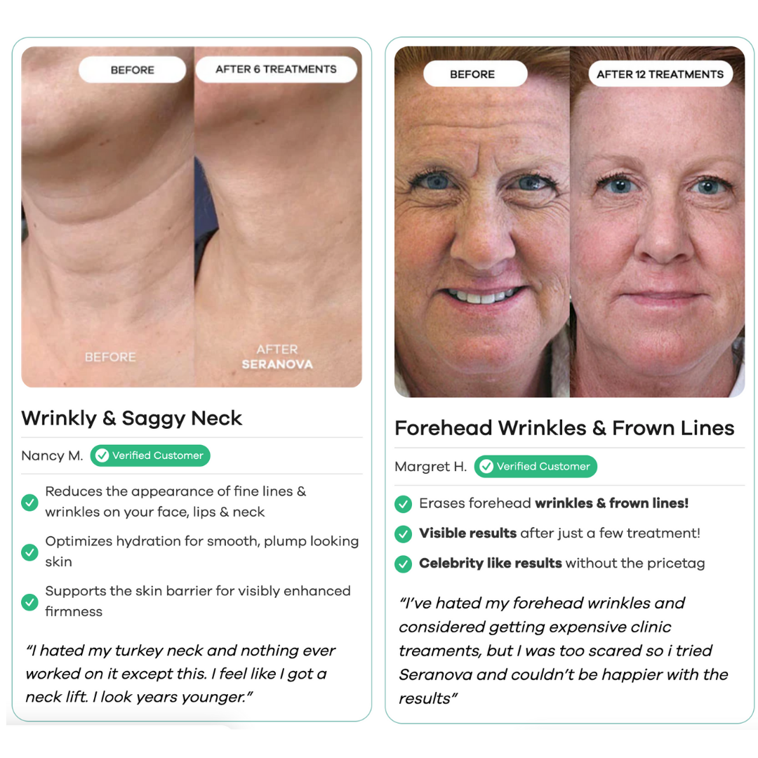 Micro-Infusion Skincare Treatment (For Dark Spots & Wrinkles)
