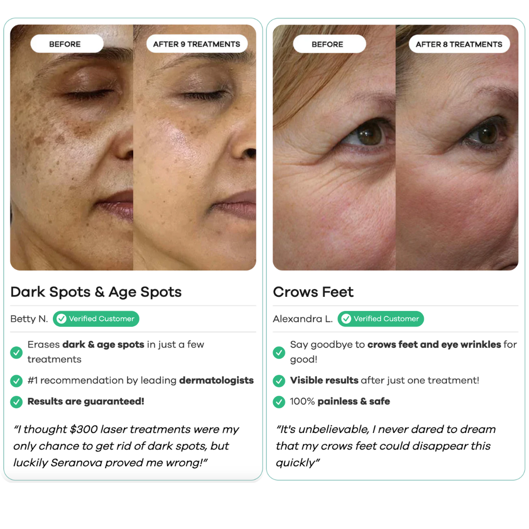 Micro-Infusion Skincare Treatment (For Dark Spots & Wrinkles)